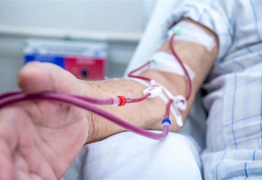 New tariff for a dialysis session in the coming days